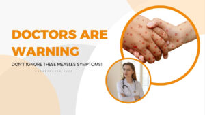 Close-up of hands with measles rash and doctor advising caution