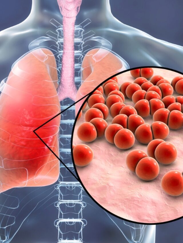 7 critical warning signs of pneumonia in children, including rapid breathing and chest pain, every parent must know to protect their child's health.